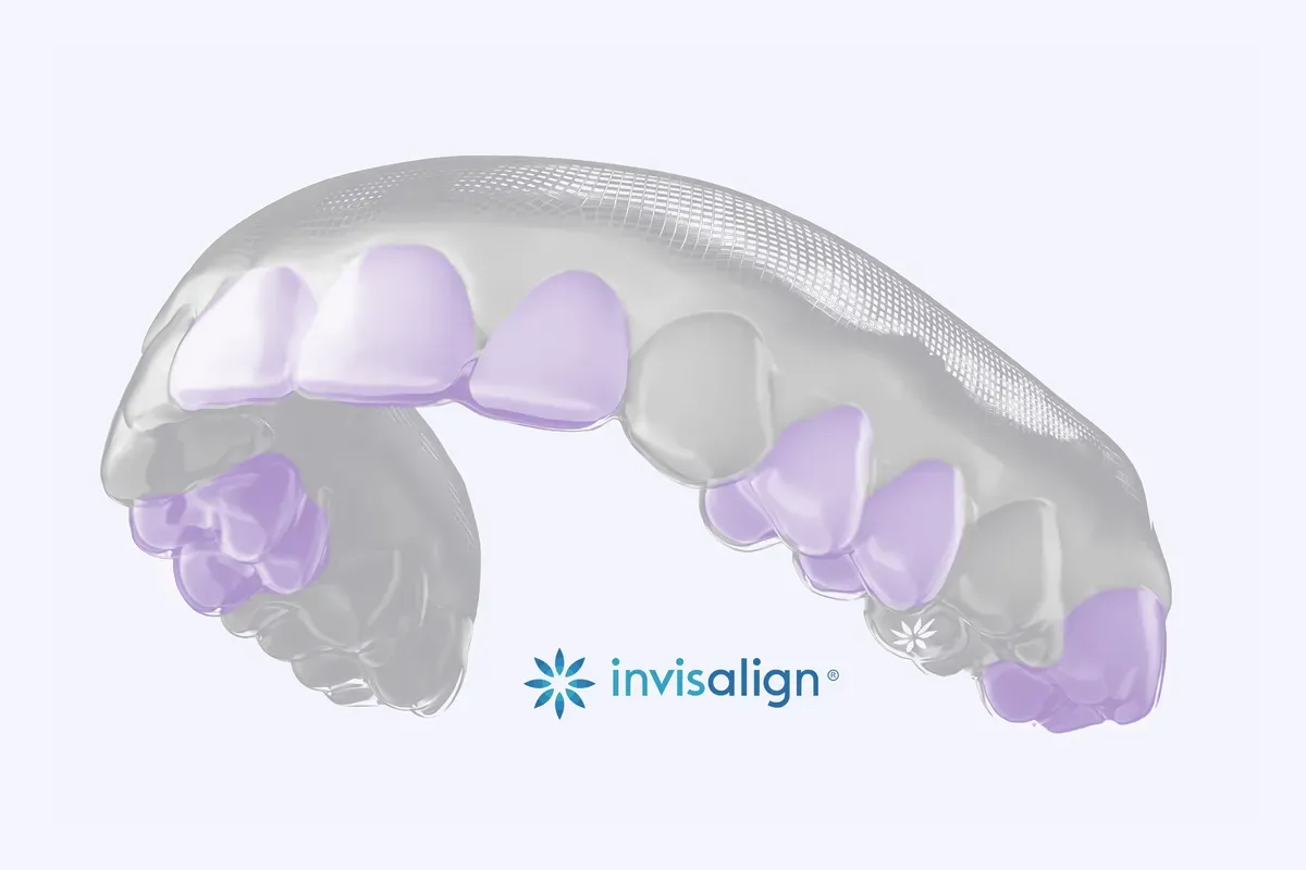 Imed Invisalign Aparatic Prikaz