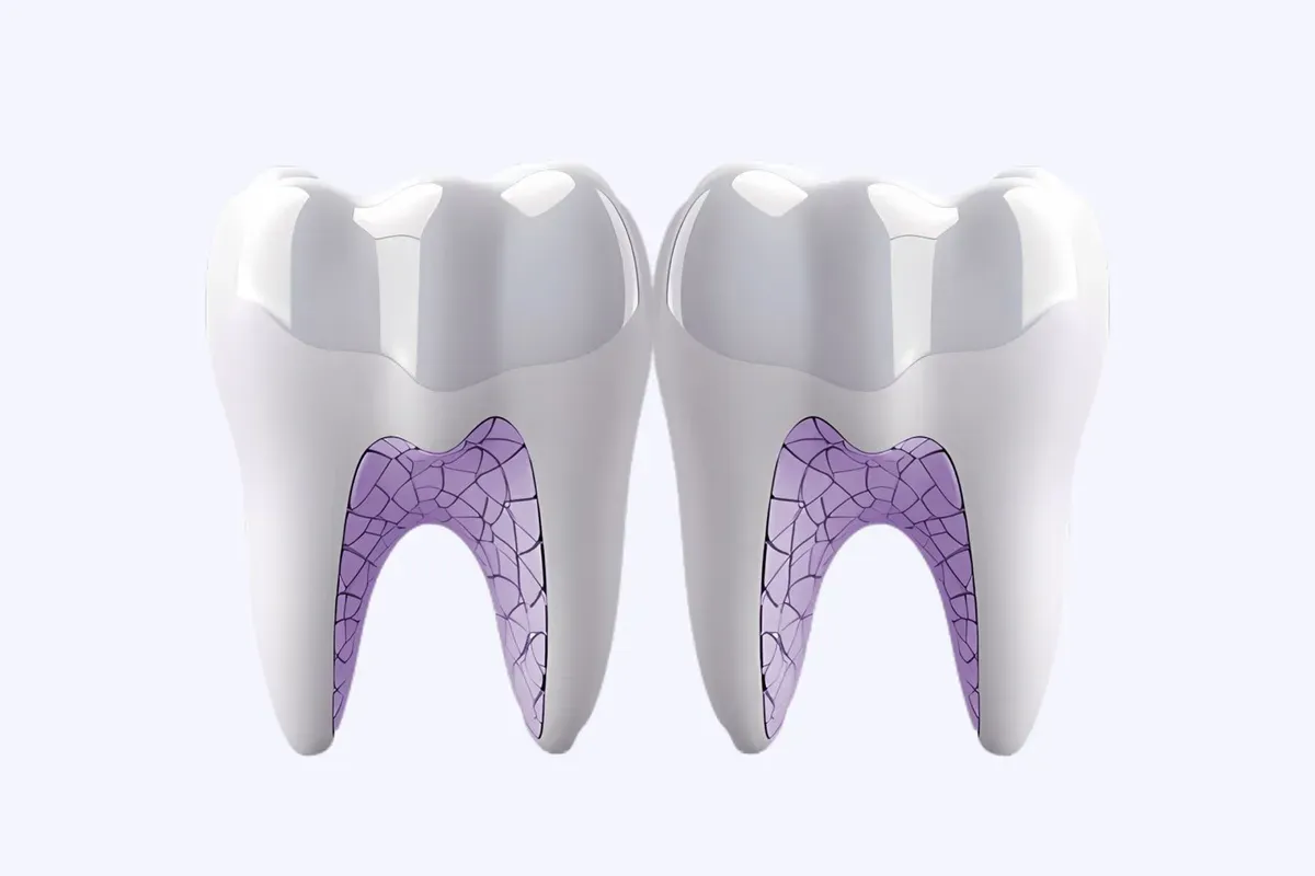 Imed Endodoncija Postendodontska Opskrba Zuba