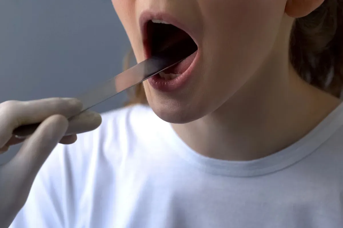 Pregled Grla Stapicem