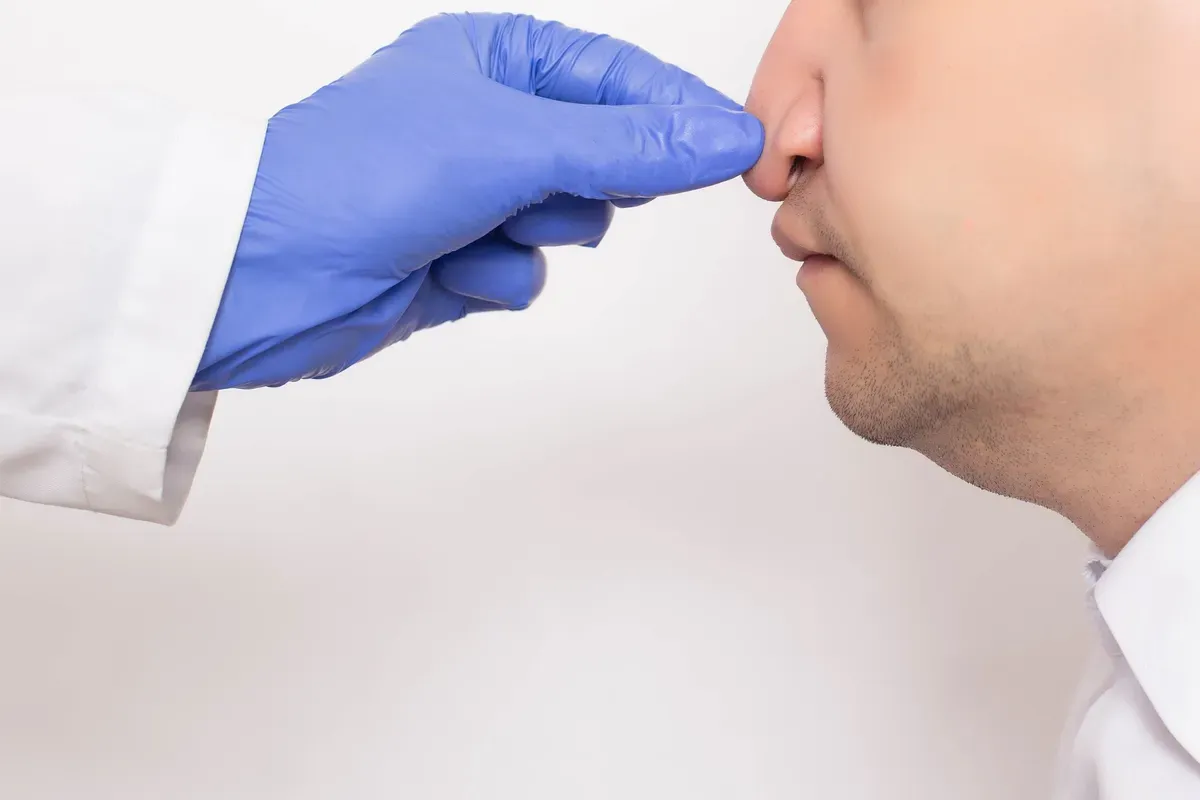 Septorinoplastika Muskarac Orl