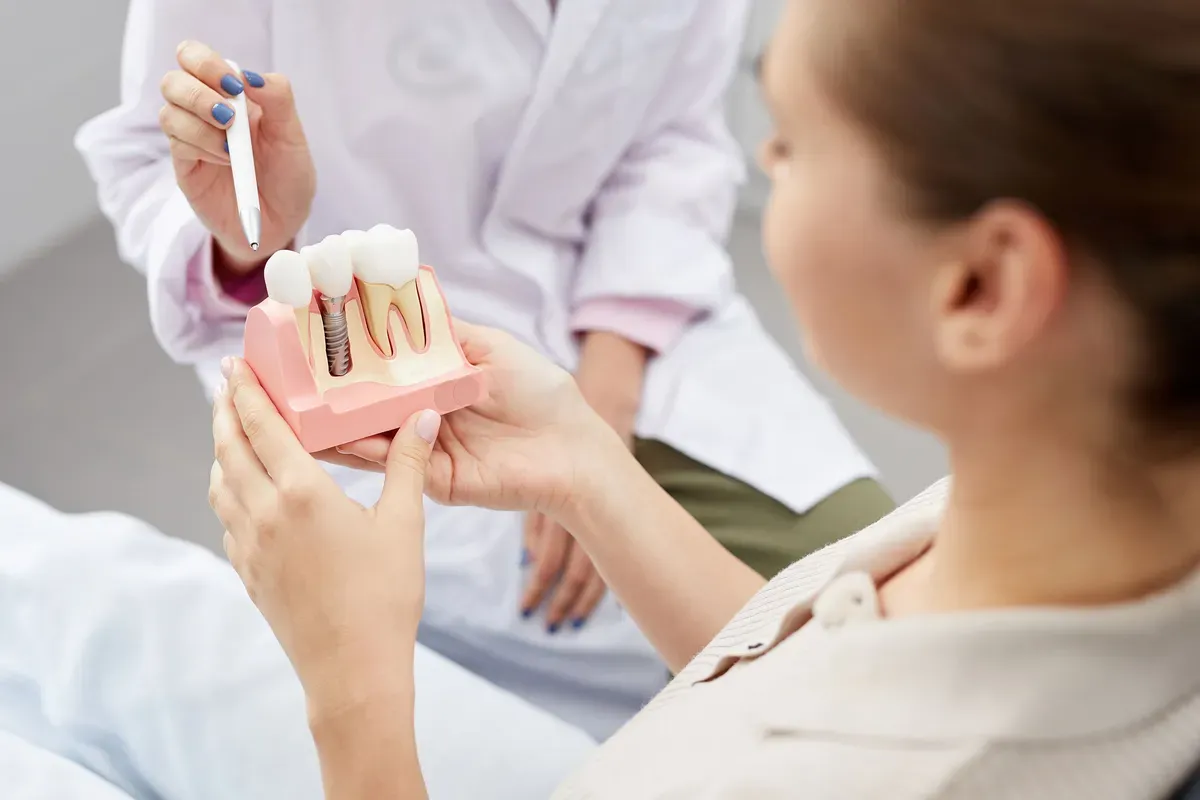 Savjetovanje Pacijenta Implantat Model