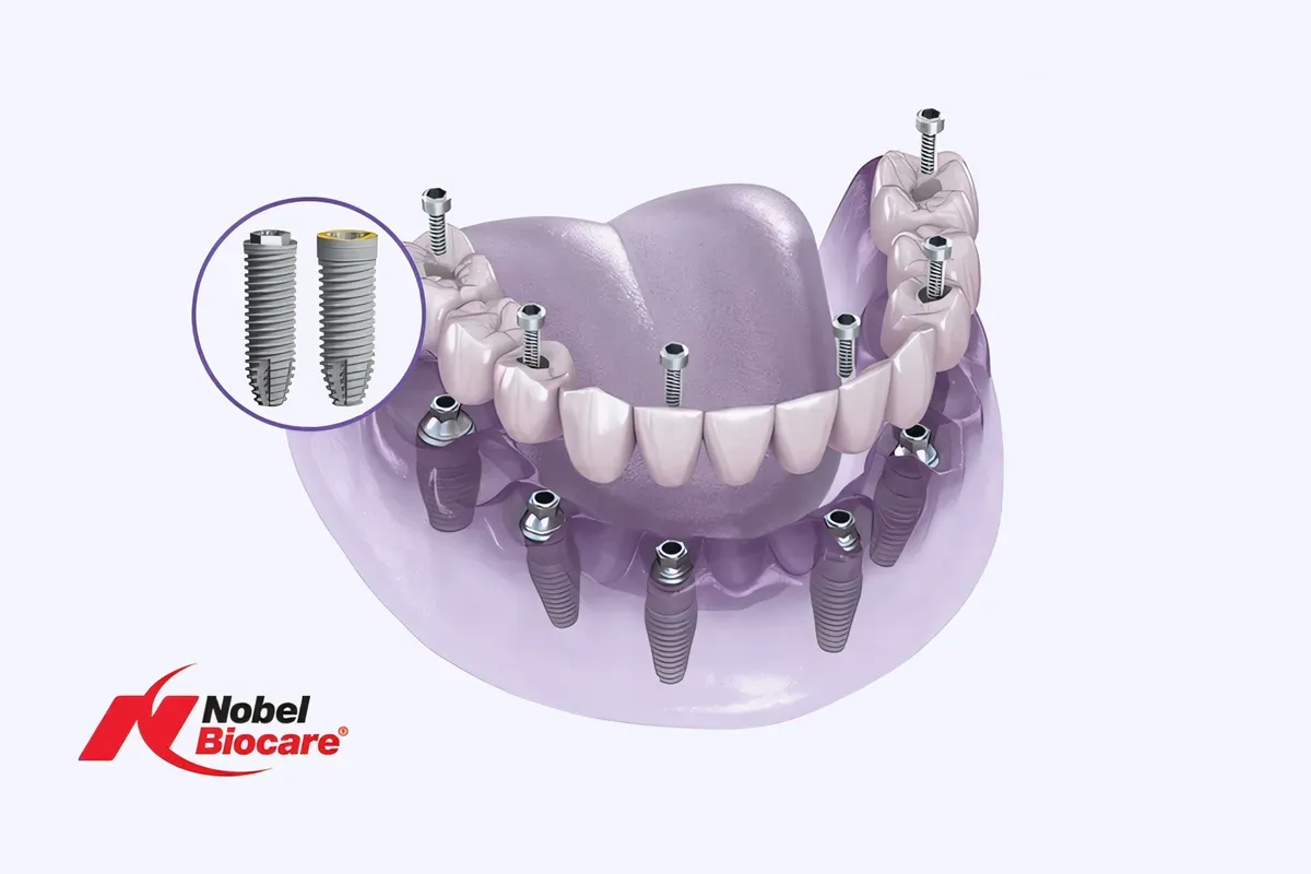 Imed Nobel Biocare All on 6 Sistem