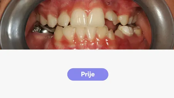 Orto Ivan R Fullface Prije V2