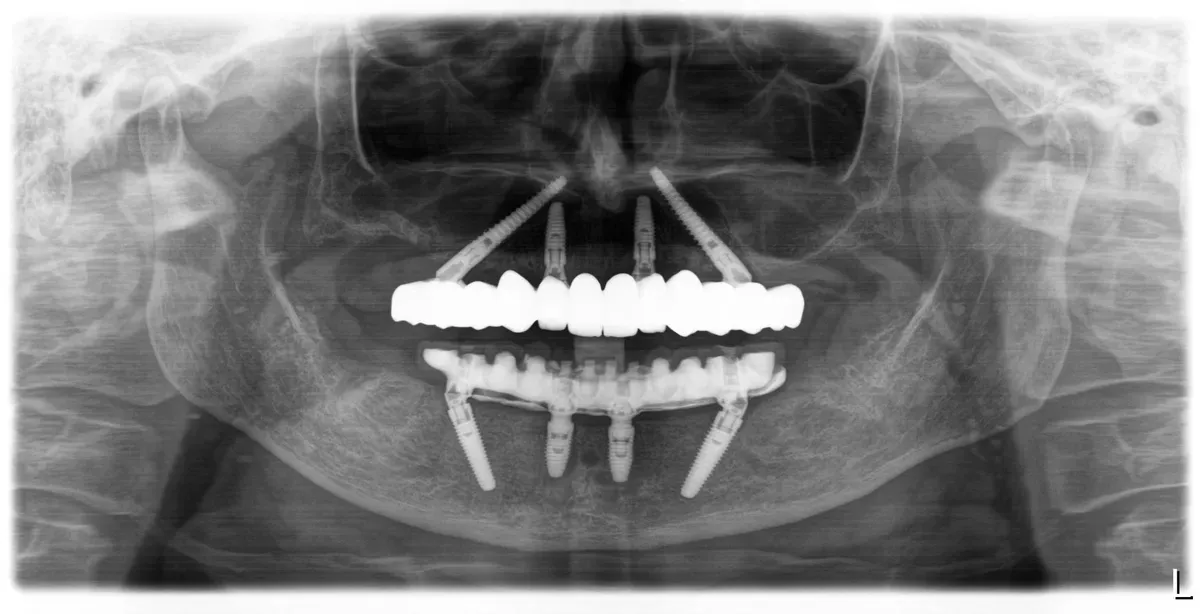 Galić Dubravka Light Box(1) P1 a 20260212 153402