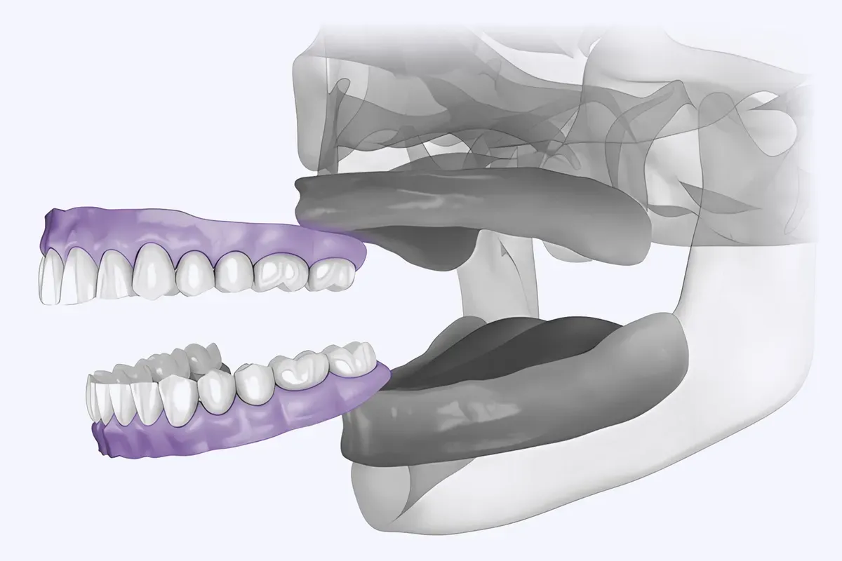 Imed Gornja Donja Totalna Proteza