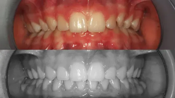 Orto Karla T Fullface Prije