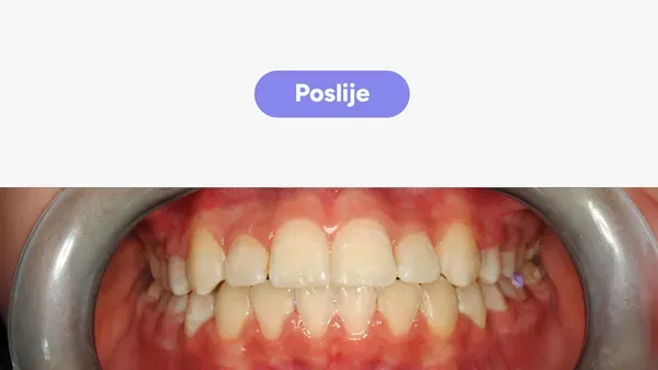 Orto Ivan R Fullface Poslije V2