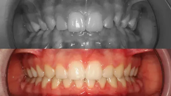 Orto Karla T Fullface Poslije