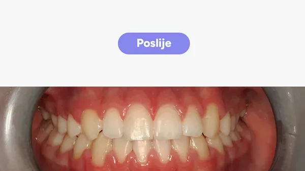 Orto Vito J Fullface Poslije V2