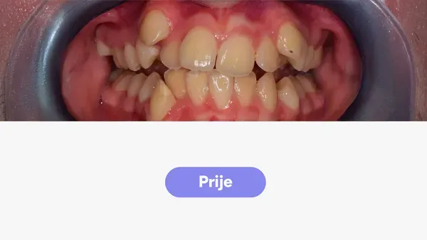 Orto Petra L Fullface Prije V2