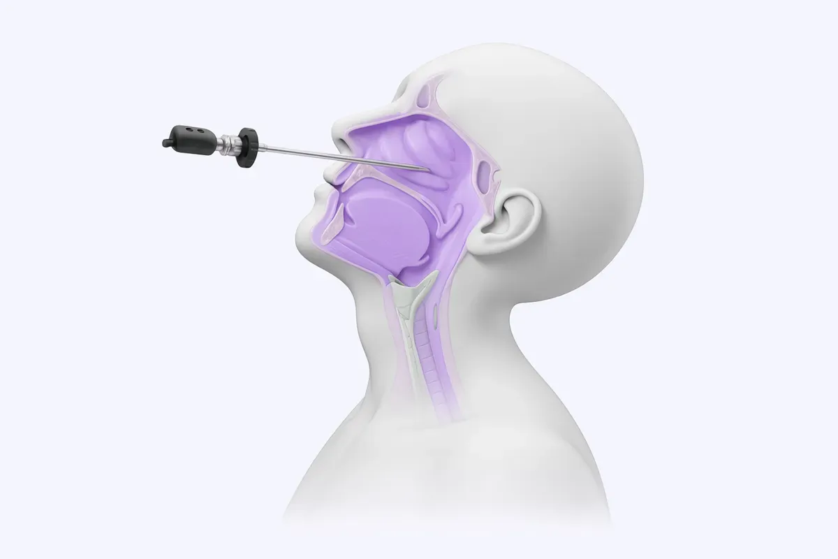 Endoskopski Orl Postupci