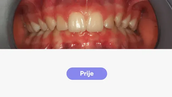 Orto Karla T Fullface Prije V2
