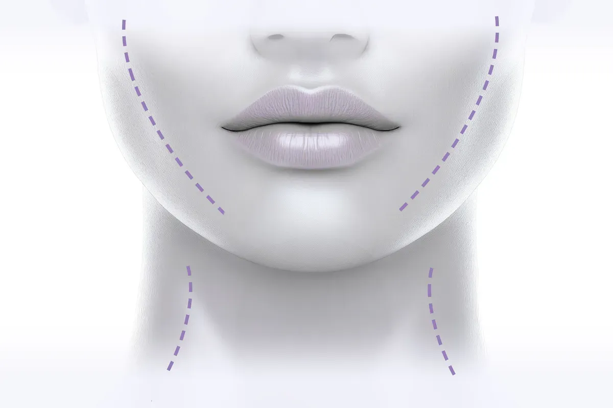 Imed Facelifting Konture Lica Vrata