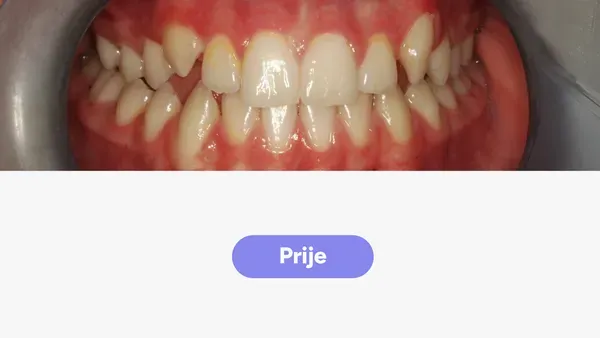 Orto Vito J Fullface Prije V2