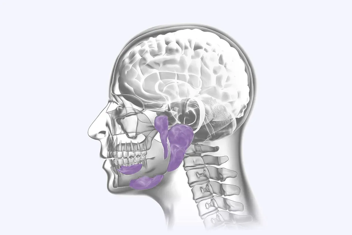 Incizija Kanala Zlijezde Slinovnice