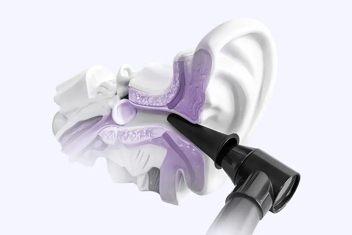 Otomikroskopija I Toaleta Uha