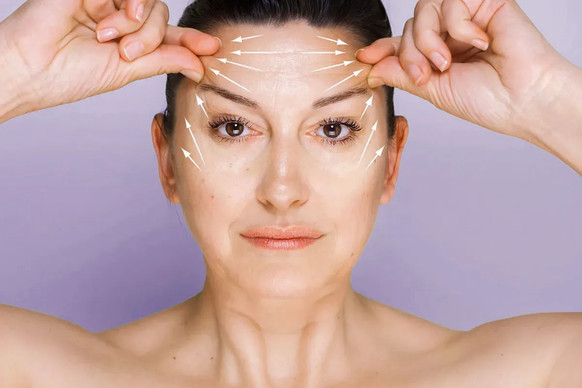 Brow Lift Smjerovi Podizanja Lica