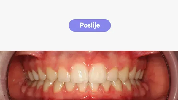 Orto Karla T Fullface Poslije V2