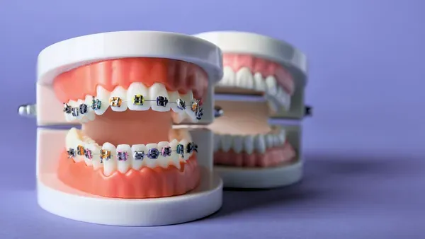 Imed Blog Invisalign Vs Fiksni Aparatic 1