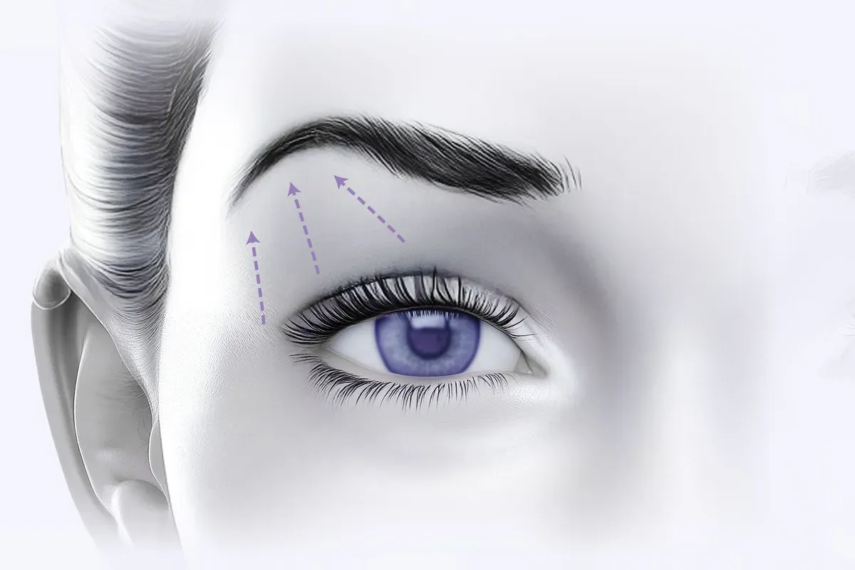 Imed Brow Lift Podizanje Obrva Prikaz