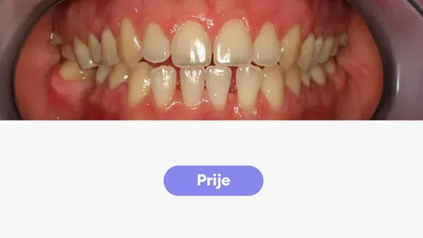 Orto Tea S Fullface Prije V2